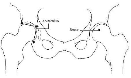 [Image: Downs hip.jpg]